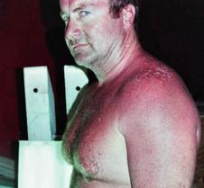 daddy getting sunburned