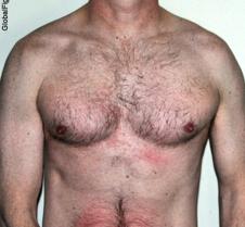 gut punched stomach red swollen