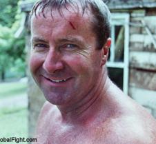 police officer cut forehead