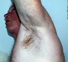 armpits huge thick hairy